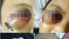 快訊 | 華潤水泥分廠發生事故！（附圖）